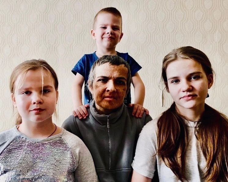 Помогите детям Марины снова гулять с мамой по парку