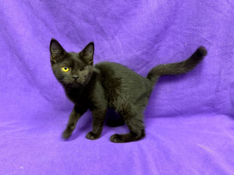 Панофтальмит лишил Лину глаза, но не шансов на счастливое будущее — помогите