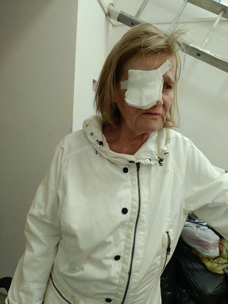Жестокость подростков сделала Ирину инвалидом — поможем ей выстоять