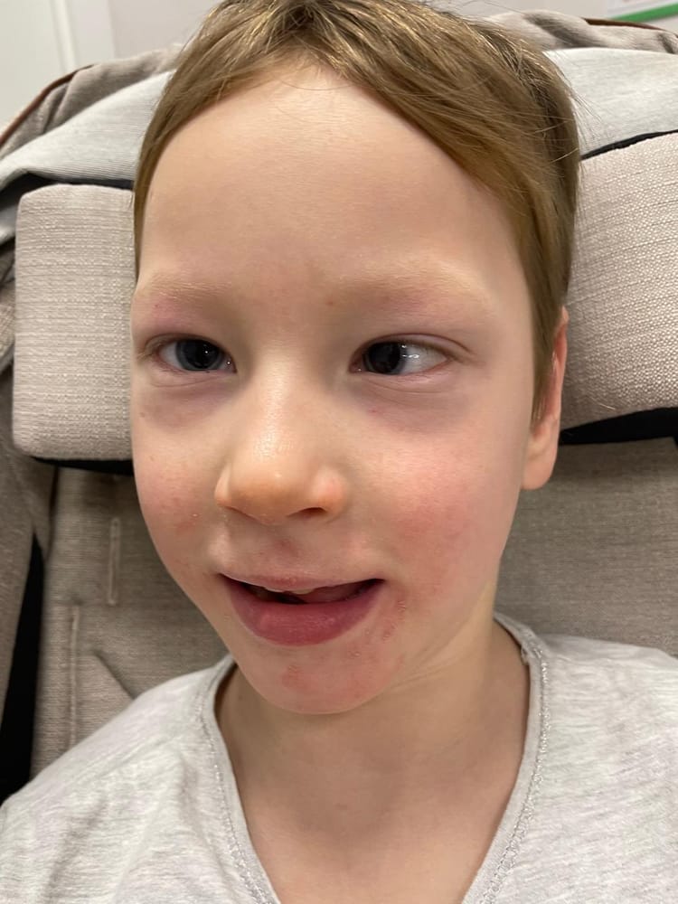 Сейчас Даша готова развивать своих успехи в реабилитации, но нужна помощь с совсем базовыми вещами